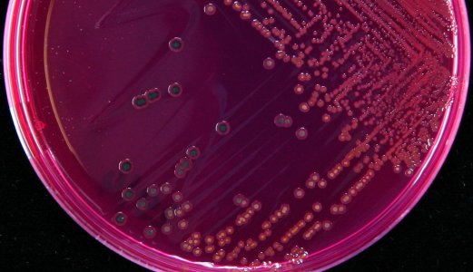 Utbrudd av salmonella