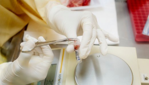 CWD-laboratoriet satte dagsrekord