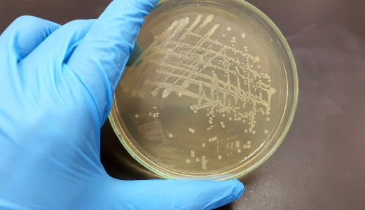 Salmonella Newport påvist i alalfaspirer i forbindelse med nasjonalt utbrudd