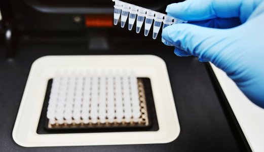 Diagnostiske tester: Hva sier de?