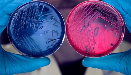 Over 1000 prøver analysert for salmonella