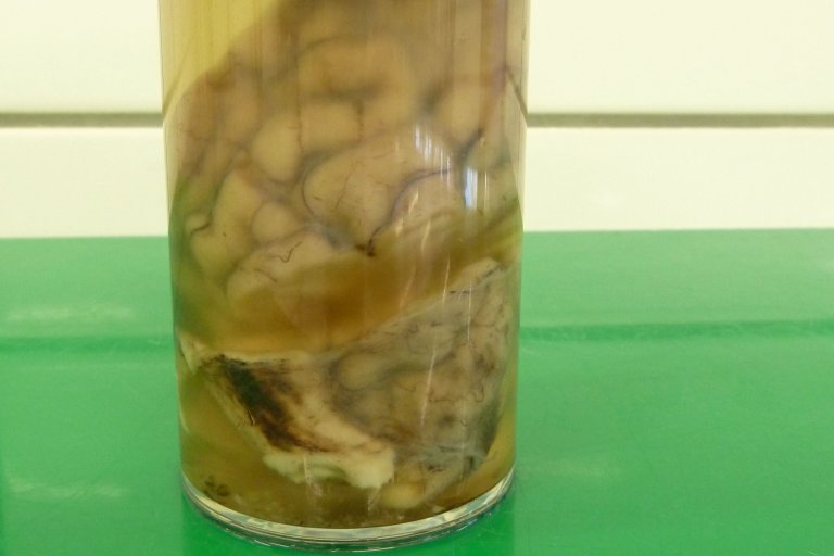 elg_hjerne2_CWD_16-60-1389-P138_foto T Vikøren_crop.jpg