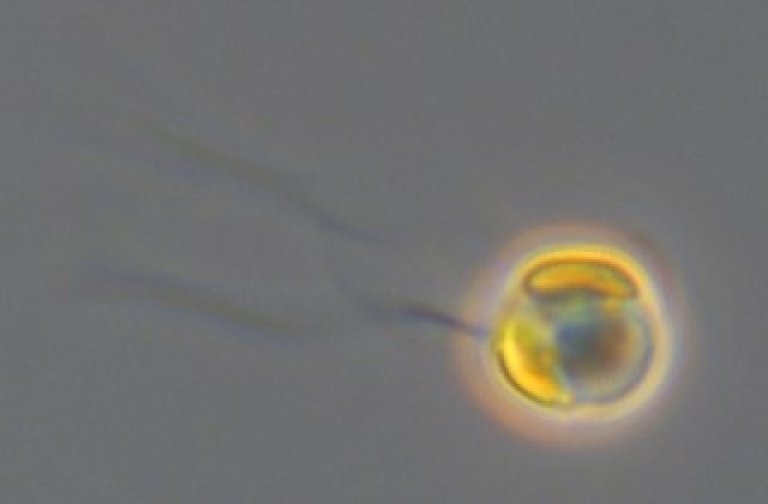 Celle av Chrysochromulina leadbeateri sett med differensiell interferenskontrast (DIC) lysmikroskopi.