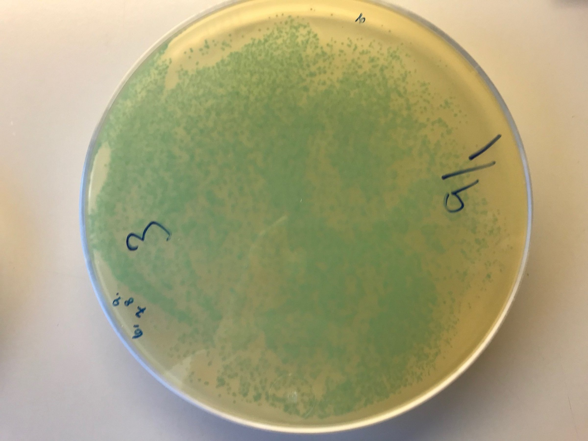 Listeriose er ein sjeldan, men alvorleg sjukdom som hovudsakleg råkar gravide, eldre med svekka helsetilstand og andre personar med nedsett immunforsvar. Foto: Veterinærinstituttet