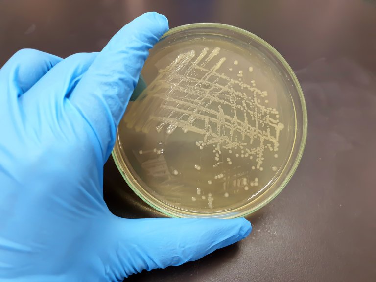 Bakterien Salmonella synlig i en petriskål