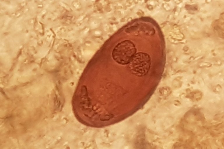 Mikroskopbilde av egg av liten leverikte.